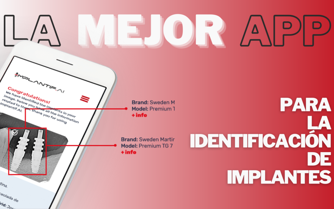 10 razones por las que Implantifai es la mejor app para la identificación de implantes