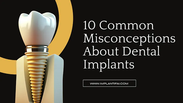 Unmasking the Truth: 10 Dental Implant Misconceptions Debunked with AI Magic!