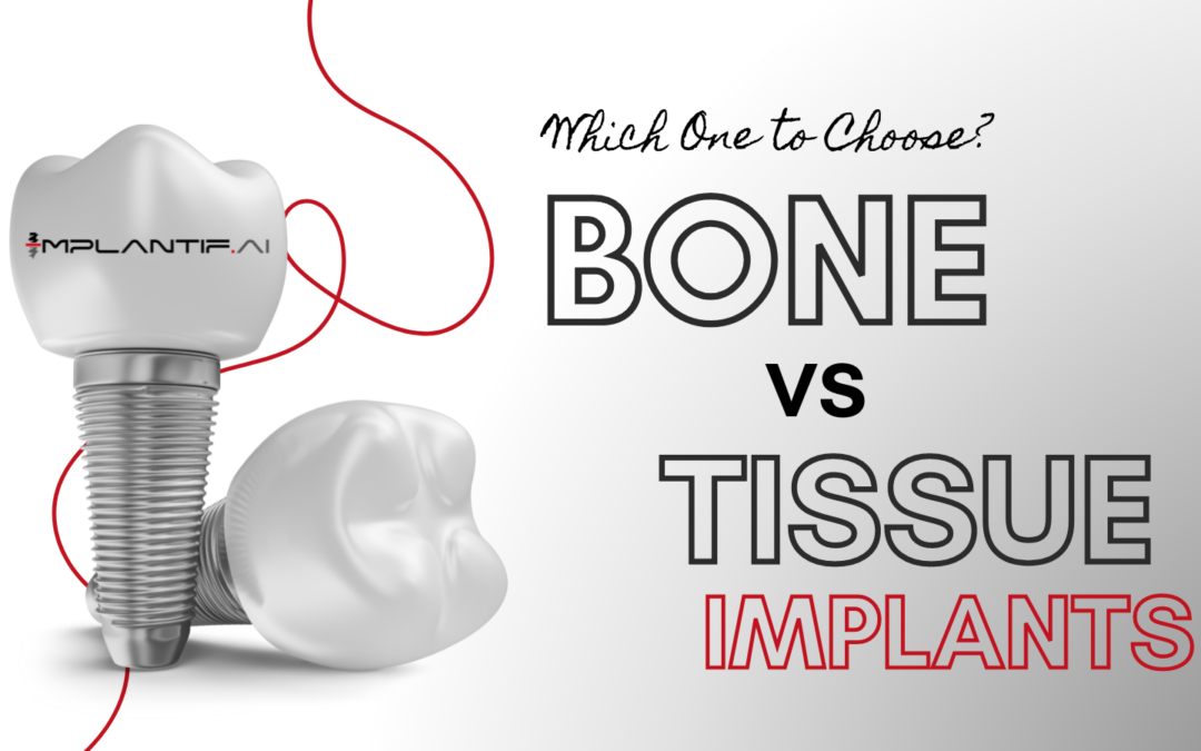 Bone Level vs Tissue Level Implants: Which One Should You Choose?