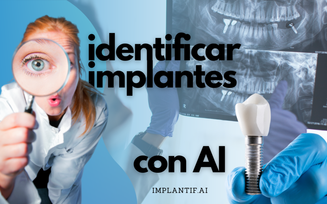 Aligerando la carga con la IA: una guía amigable para identificar diferentes tipos de Implante