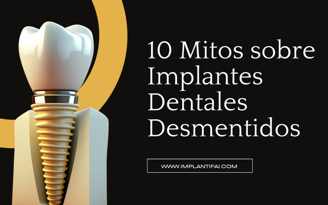 Descubriendo la Verdad: 10 Mitos sobre Implantes Dentales Desmentidos con la Magia de la IA.